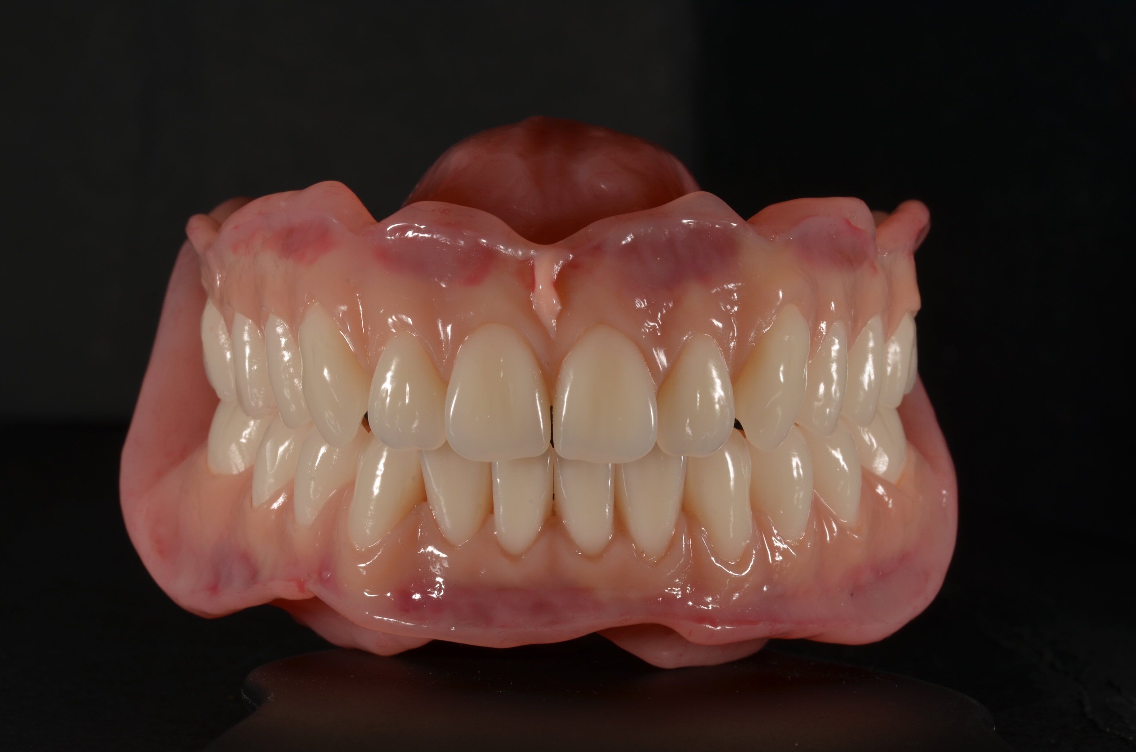 Linda's custom made full dentures near me